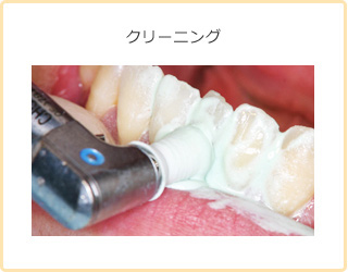 クリーニング