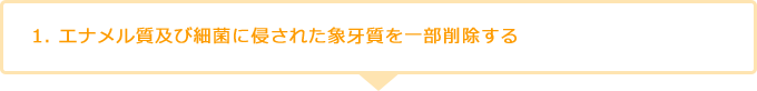 1. エナメル質及び細菌に侵された象牙質を一部削除する